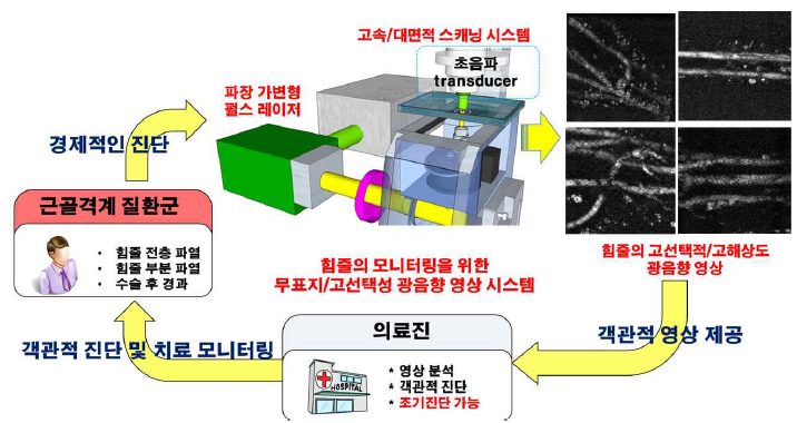 힘줄의 질환 진단과 치료 모니터링을 위한 광음향 영상 기술의 개념