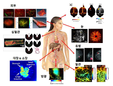 신체 부위 별 주요 광음향 연구 분야