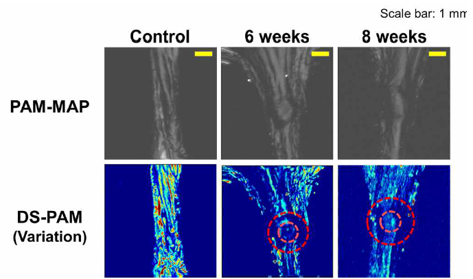 일반 PAM과 DS-PAM으로 본 힘줄의 상처치유과정