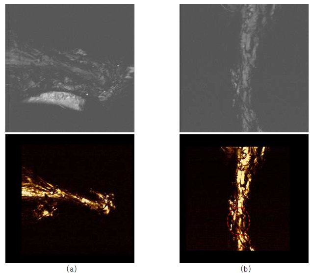 In-vivo 실험으로 획득한 실험용 동물의 힘줄 광음향 영상 (a) 정상 힘줄의 광음향 영상, (b) 파열된 힘줄의 광음향 영상