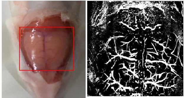 (좌) 살아 있는 생쥐의 뇌 사진, (우) 획득된 쥐의 뇌혈관 광음향 영상