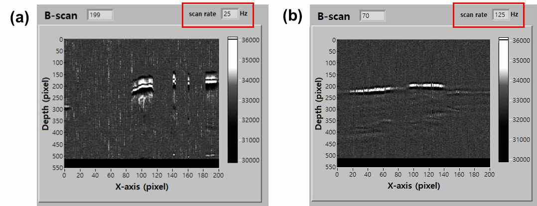 고속 영상 출력 속도 (a) 10 kHz의 반복률을 가지는 광음향 영상의 25 frames/sec의 속도, (b) 50 kHz의 반복률을 가지는 광음향 영상의 125 frames/sec의 속도