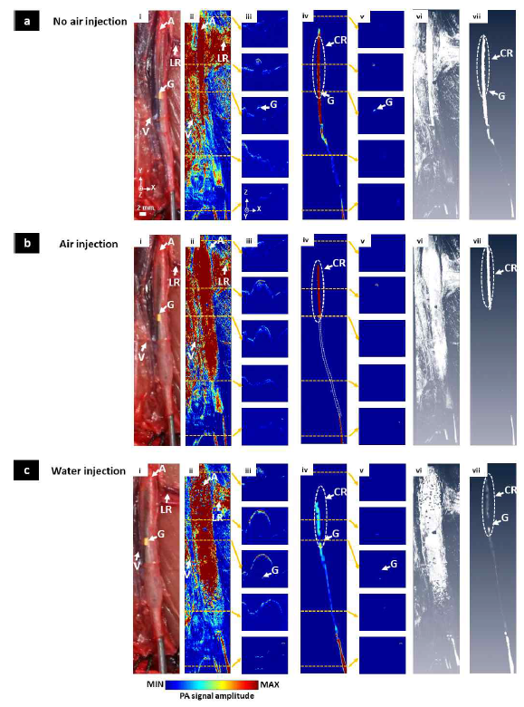 고속 대면적 스캐닝 방법을 활용한 풍선 카테터 대동맥 혈관 내 가이딩 광음향 영상. (a) 풍선에 공기가 없을 시, (b) 풍선에 공기 주입 시, (c ) 풍선에 물 주입 시 대동맥 혈관 내 풍선 카테터 가이딩 광음향 영상