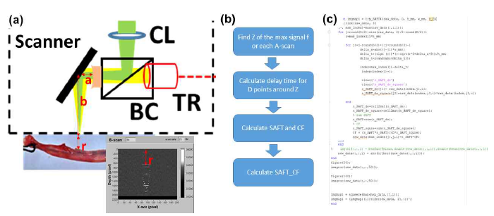 현재 개발된 광음향 스캐너에서 해상도 향상을 위한 합성 개구면 포커싱 기술 적용 프로세스. (a) 고속 광음향 스캐너에서의 구조적 정보, (b)합성 개구면 포커싱 기술 적용 순서도, (c) 적용된 Matlab 코드