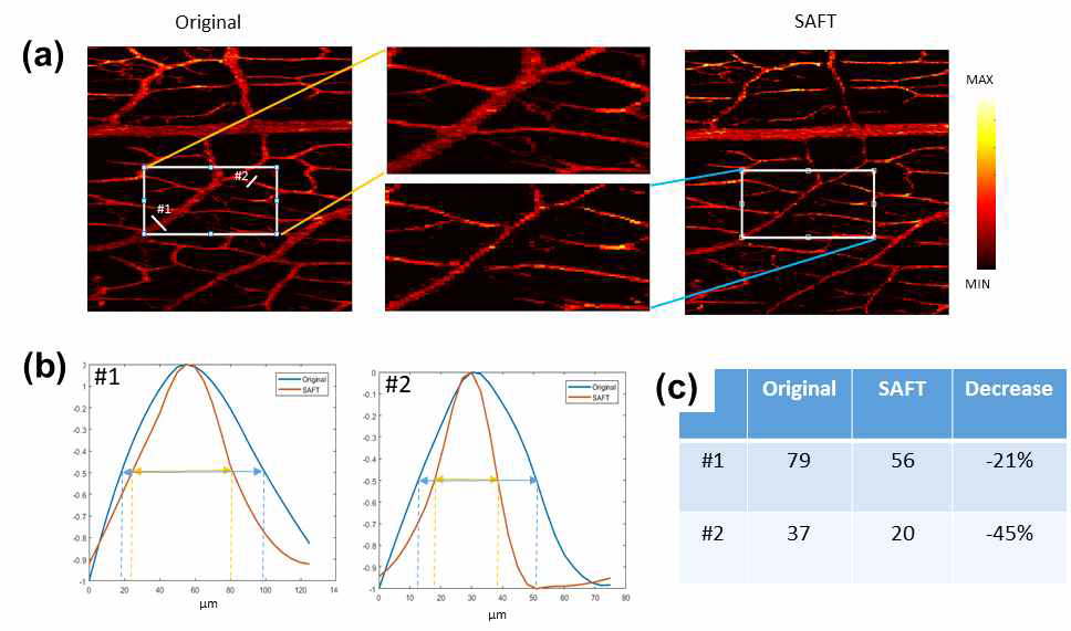 생체 조직에서의 합성 개구면 포커싱 기술 적용. (a) 생체 혈관 조직에서의 적용 전과 후의 광음향 영상, (b) #1과 #2에서의 광음향 신호 반치폭 측정 프로파일, (c) 기술 적용 전후의 반치폭 측정을 통한 해상도 향상 정도 테이블