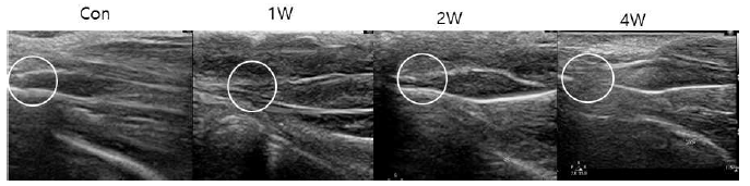아킬레스 힘줄의 3mm 부분 절제 모델의 술 후 1주, 2주, 4주째 결손부 초음파 영상