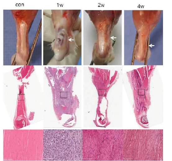 아킬레스 힘줄의 3mm 부분 절제 모델의 술 후 1주, 2주, 4주째 결손부 조직학적 소견