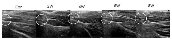 아킬레스 힘줄의 반 절개 모델의 술 후 2주, 4주, 6주, 8주째 결손부 초음파 영상