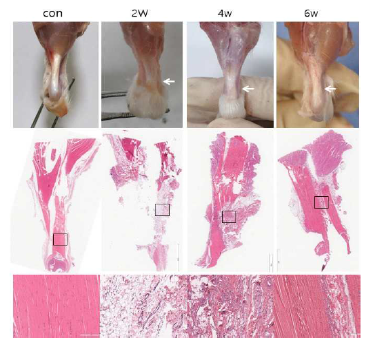 아킬레스 힘줄의 주사바늘 이용한 최소 절개 및 좌골신경 절단 모델의 술 후 2주, 4주, 6주째 결손부 조직학적 소견