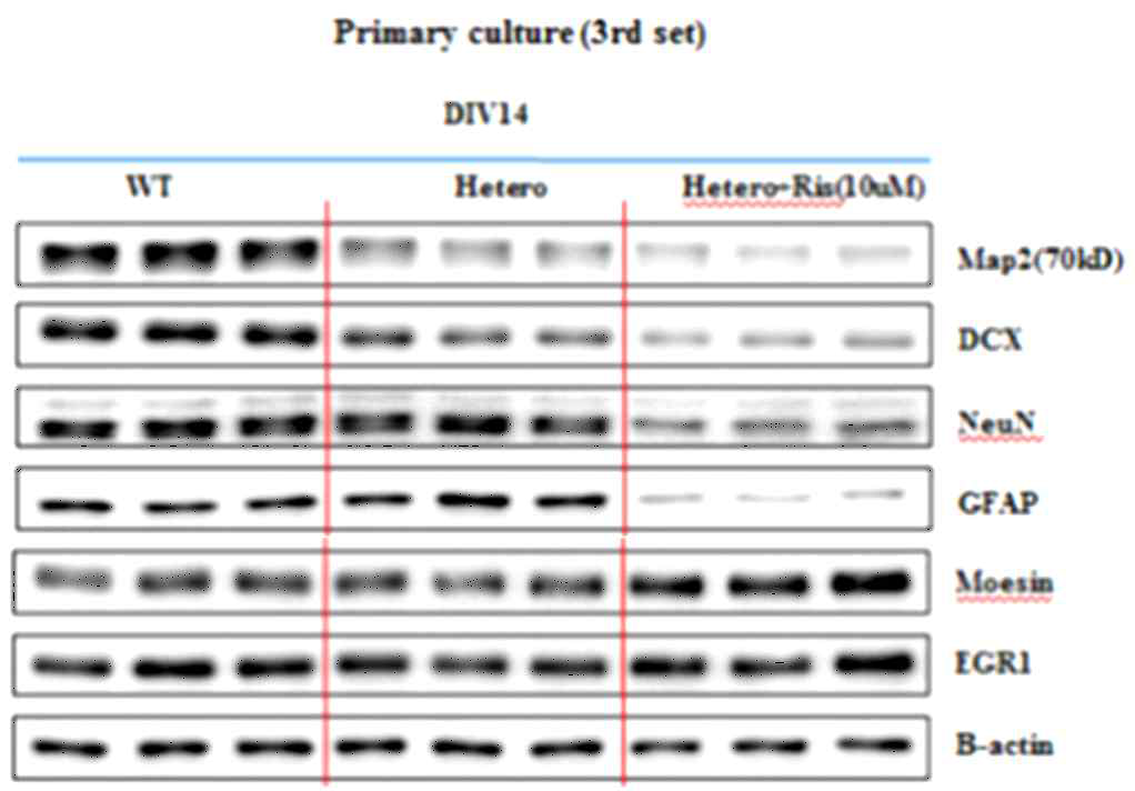 Cortical Primary culture (E16) DIV3에 리스페리돈 10μM 씩 48시간 간격으로 처리하여, DIV14에 발달병리 관련된 단백질의 발현 변화를 관찰함. 리스페리돈을 처리한 시험군에서 신경발달 단계와 관련된 단백질 (MAP2, DCX, NeuN, GFAP)의 발현량이 변화된 것을 관찰할 수 있음