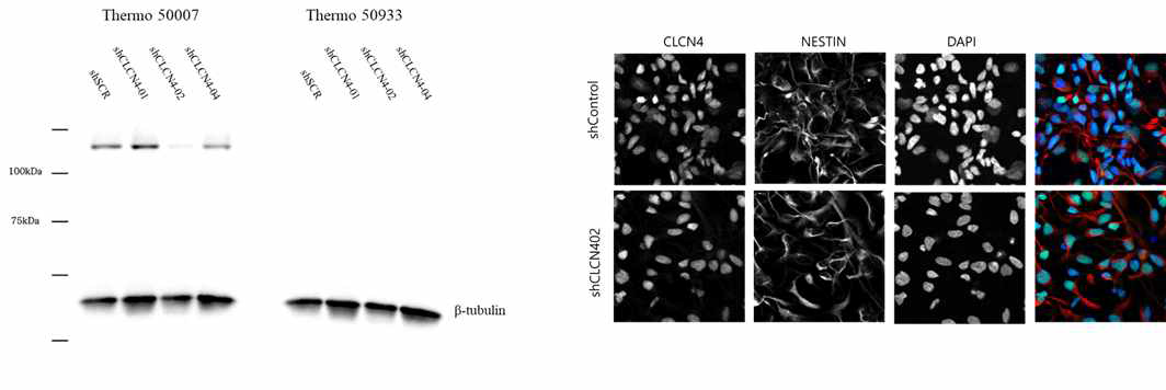 CLC-4 넉다운 신경모세포를 이용한 면역 블롯 및 면역세포화학 염색. (좌) 면역블롯을 진행한 결과 해당 항체가 CLC-4 단백질의 크기와 다른 크기에 해당하는 단백질을 검침하거나 어떤 단백질도 검침하지 못하는 것을 확인. (우) 면역세포화학 염색을 진행한 결과 CLC-4가 세포 내에서 주로 존재하는 위치인 세포질이 아닌 핵에서만 해당 항체가 단백질에 특이적으로 결합함. 면역 블롯과 면역세포화학 염색 결과를 통해, CLC-4 특이적 항체가 CLC-4를 검침하지 못하는 것으로 판단할 수 있었음