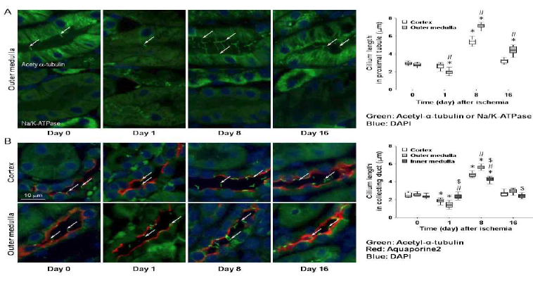 손상된 신장 세뇨 관세포에서 일차섬모 길이 변화. 생쥐 신장의 혈관을 30분간 결찰하여 허혈을 유발한 후 신장을 취함. 이 신장 조직을 ac-a-tubulin (녹색, 일차섬모의 지표), Na/K-ATPase(원위세뇨관에서 진한 녹색, 근위세뇨관 약한 녹색)과 AQP2(빨간색, 집합관에서 발현), DAPI(파란색, 세포핵)로 면역 염색함