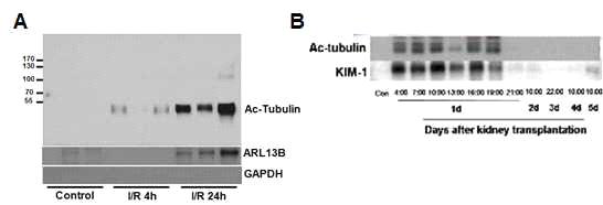 허혈/재관류 유도 후 생쥐(A)와 신장이식 환자(B)의 소변으로 일차섬모의 방출. (A) 생쥐를 30분간의 허혈유도 후 4 및 24시간 후 소변을 취하여 anti-ac-tubulin, -ARL13B과 -GAPDH 항체를 사용하여 Western blot을 실시함. (B) 정상인의 소변(control)에서 검출 되지 않고, 또한 신장이식 후 이른 시간(24시간 이내)의 소변에서만 검출되고, 이후에는 검출되지 않음. 다른 신장 손상지표인 Kidney Injury Molecule-1(KIM-1)과도 같은 양상을 보임. 이는 콩팥의 손상시 일차섬모가 소변 중으로 떨어져 나온다는 것을 보여주는 결과임[본 연구진의 선행연구결과, 5, 7, 국제 특허등록]