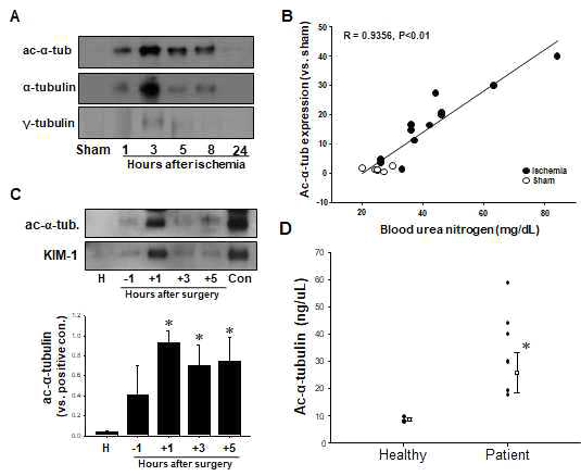 간의 허혈/재관류 유도 후 급성 신장손상이 유발된 생쥐(A,B)와 간 절제를 받은 환자(C,D)의 소변으로 일차섬모의 배출. (A) 생쥐를 부분적 간 허혈에 30분간 노출 시킨 후 1, 3, 5, 8 및 24시간 후 소변을 취하여 ac-α-tubulin, α-tubulin과 γ-tubulin항체를 사용하여 Western blot 을 실시함. (B) 혈장 내 BUN 농도를 측정하여 ac-a-tubulin과 BUN 농도의 상관성을 조사함. (C) 부분적 간 절제술을 받은 환자의 소변을 수술 전 1시간, 수술 후 1, 3 그리고 5시간후에 소변을 취해 western bolt 분석을 통해 ac-a-tubulin의 발현을 조사함. (D)소변내의 ac-a-tubulin의 양을 ELISA 분석을 통해서 확인함
