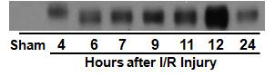생쥐를 30분간의 허혈을 유도 후 각 표시된 시간에 소변을 취하여 anti-acetylated-α -tubulin 항체를 사용하여 Western blot을 실시함