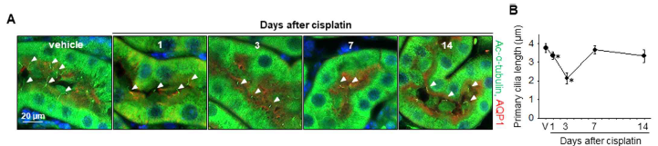 생쥐에 10 mg/kgBW의 cisplatin을 투여 후 표시된 시간에 신장세포 내 일차섬모의 길이 변화를 면역염색법을 이용하여 확인함