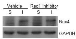 Rac1 억제제 투여가 허혈/재관류 유도 후 Rac1, NOX시스템 발현에 미치는 영향을 Western blot을 통해 확인함