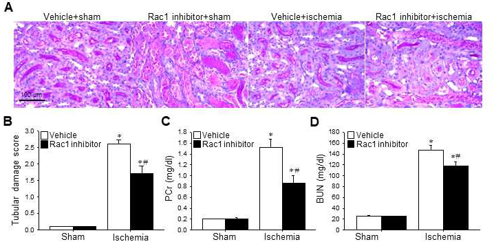 Rac1 억제제 투여가 허혈/재관류 유도 후 신장의 구조 및 기능적 손상 정도를 PAS 염색과 혈중 크레아티닌 및 혈액 요소질소 농도를 측정하여 확인함