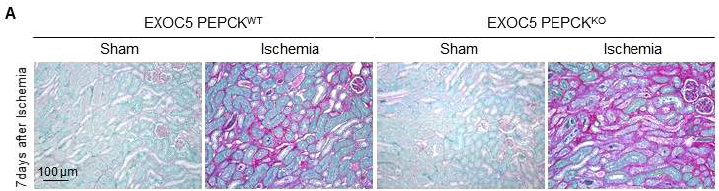 허혈/재관류 손상 후 근위세뇨관 세포 특이적 EXOC5 Knock out 생쥐에서 신장의 섬유화 비교. Wild type과 PEPCK cre:EXOC5f/f 생쥐의 양측 신장에 20분의 허혈 후 재관류 및 개복수술(Sham)을 실시하였음. 수술 후 7일 째 신장 조직을 고정하여 Sirius red 염색으로 신장의 섬유화 정도를 확인하였음. *,p<0.05 vs. respective sham; #,p<0.05 vs. wild type ischemia