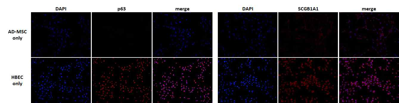 혼합배양액에서 5일간 배양한 AD-MSC와 hBEC의 p63과 SCGB1A1의 면역염색평가