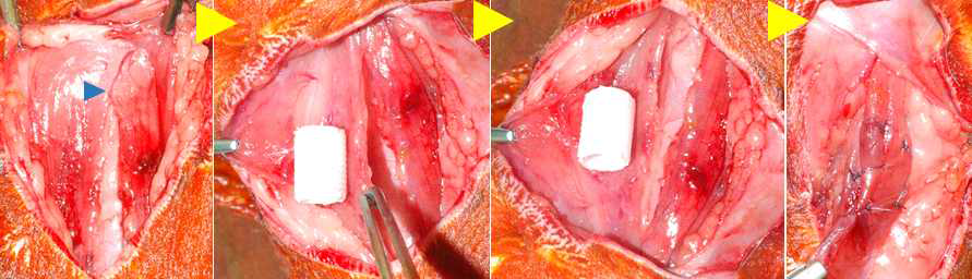 Strap muscle에 기관 지지체 일차 이식 모습. 파란 화살표 머리: 근육 조직의 혈관으로 지지체에 신생혈관을 유도하기 위해 선정된 혈관.(노란색 화살표: 이식 순서)