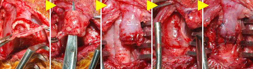 Matrigel-coated PCL scaffold를 platysma에 일차 이식 4주 후, 기관 결손 부위로의 이차 이식. (노란색 화살표: 이식 순서)