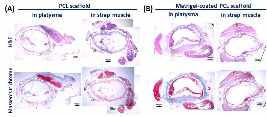 (A) 각 조직에 일차 이식 4주 후 PCL scaffold의 조직병리학적 평가. (B) 기관 결손 부위로 이차 이식 후 Matrigel-coated scaffold의 조직병리학적 평가