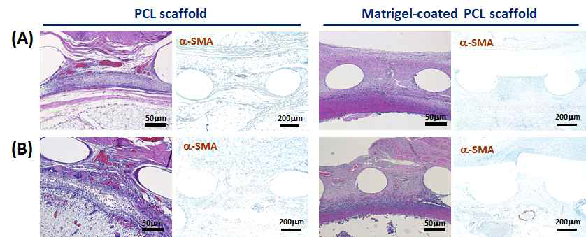 Angiogenesis 평가를 위한 조직병리학적 모습. (A) Platysma에 일차 이식과 (B) strap muscle에 일차 이식. Matrigel coated scaffold의 경우, 기관 결손 부위로 이차 이식 후 의 조직병리학적 모습