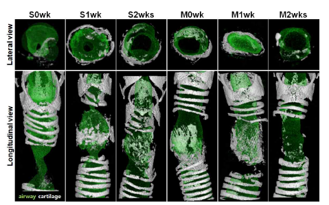 실험 종료 후 기관의 reconstructed microCT 이미지