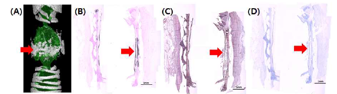 (A) S1wk의 microCT이미지와 calcium-like signal (붉은 화살표). (B) Von Kossa 염색 이미지 (black: calcium, pink: nuclei). (C) Safranin O 염색 이미지 (orange to red: cartilage, black: nuclei). (D) Collagen type Ⅱ 면역염색 이미지 (brown: collagen type Ⅱ, blue: nuclei)