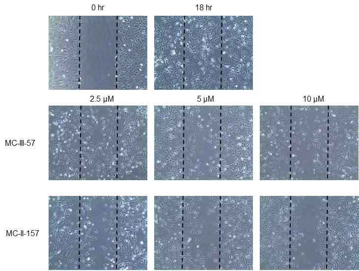 약물 농도별 세포 이동성 저해 효능 평가