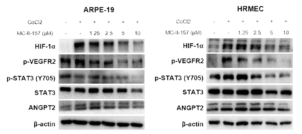 ARPE-19와 HRMEC 세포에서의 MC-II-157의 HIF-1α 조절능 및 하위기전 확인
