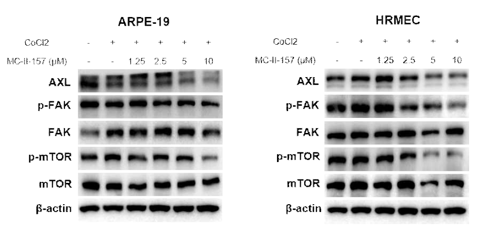 ARPE-19와 HRMEC 세포에서의 MC-II-157의 AXL 조절능 및 하위기전 확인