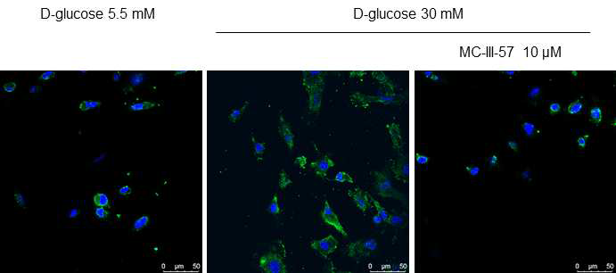 형광 현미경을 통한 MC-III-57의 고혈당으로 유도된 ANGPT2 저해능 평가