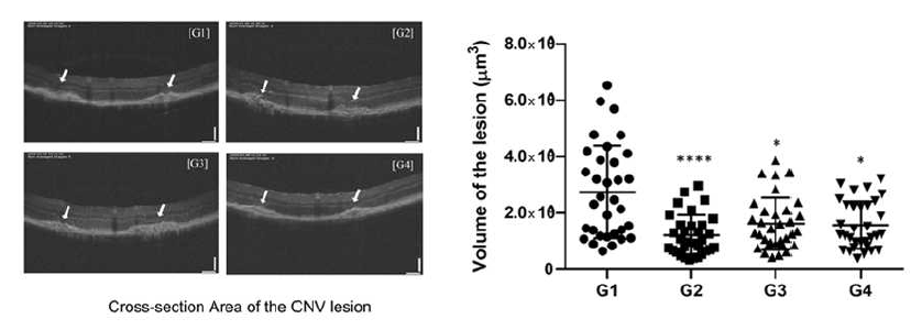 CNV mouse model에서의 유도체 활성 평가 (OCT)
