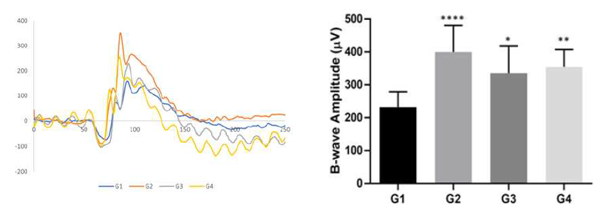 CNV mouse model에서의 유도체 활성 평가 (ERG)