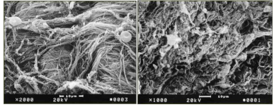 자궁경부가 부드러워진 전후의 콜라겐 구조 (Ludmir et al., Clin Obstet Gynecol. 2000 Sep;43(3):433-9)