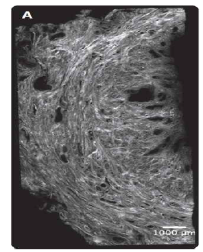 임신하지 않은 자궁경부의 횡단면 (Feltovich et al.,Am J Obstet Gynecol. 2012 Nov;207(5):345-54)