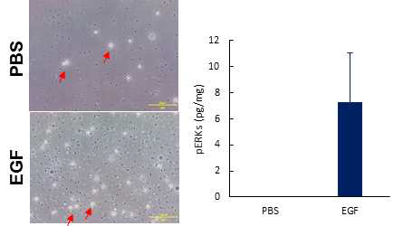 PBMC 분리 및 pERKs level 측정