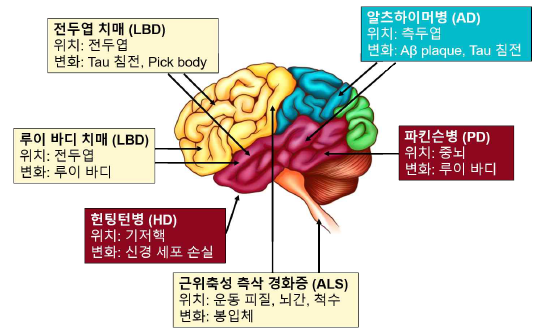 퇴행성뇌질환과 단백질 병리응집체 (pathological protein aggregates)