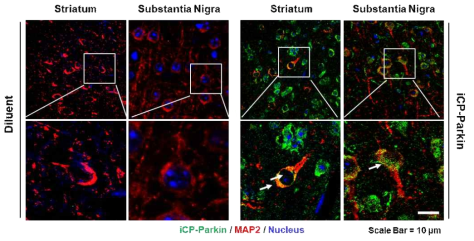 iCP-Parkin의 뇌 신경세포 투과능. Immunohistochemistry for iCP-Parkin in mouse cortex, striatum and substantia nigra after i.v. injection of Parkin recombinant protein. Anti-Parkin antibody, and anti-MAP2 antibody for neurons