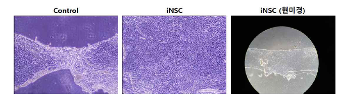 SCI 질환모델의 척수 회복 양상 (Control vs. iNSC injection)