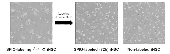 유도신경줄기세포에 SPIO labeling