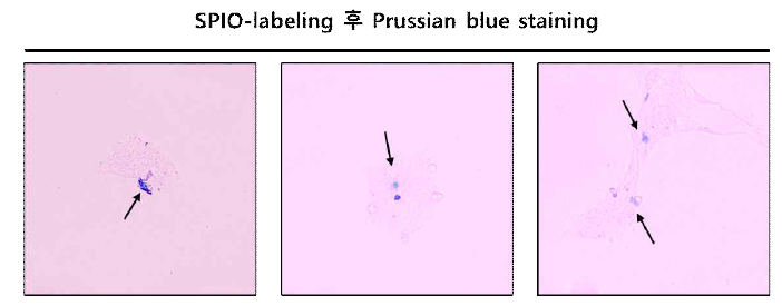 SPIO labeling한 유도신경줄기세포의 Prussian blue staining