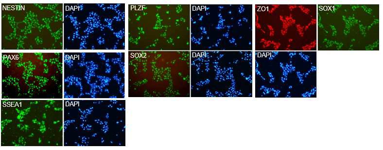세포면역염색법을 이용하여 신경줄기세포마커의 발현 확인 (iNSC-M26-0321)
