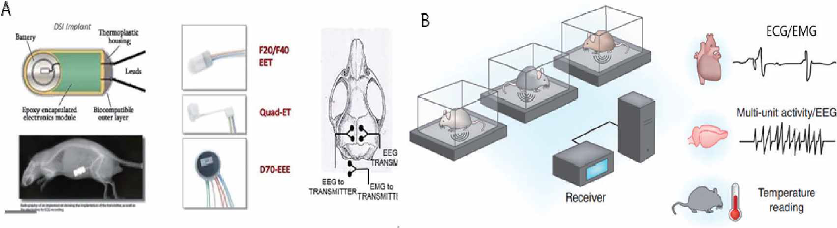 뇌파 측정 Telemetry 구성 및 이식 부위 (A), 뇌파 측정 및 분석결과 모식도 (B)