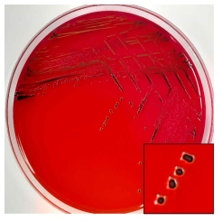 Salmonella spp. on XLD agar