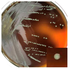 Listeria monocytogenes on Palcam agar