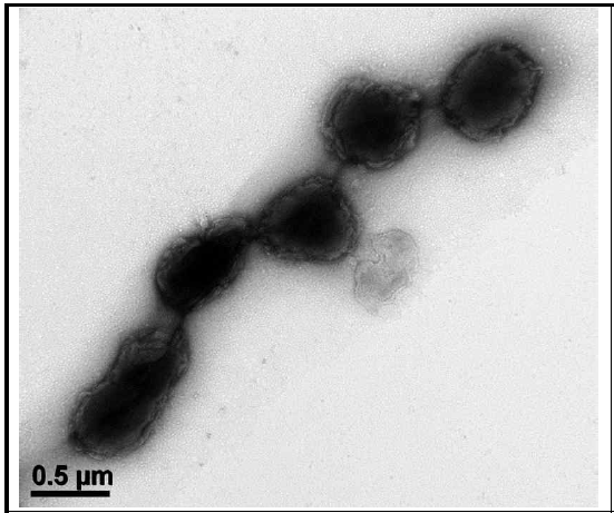 KSB-15 균주의 Bio-TEM 사진