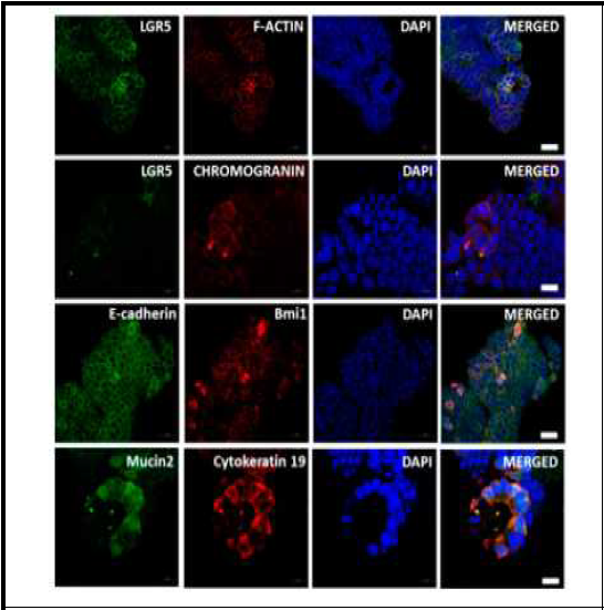 장 오가노이드의 장 성체줄기세포 특이적 단백질 발현 분석
